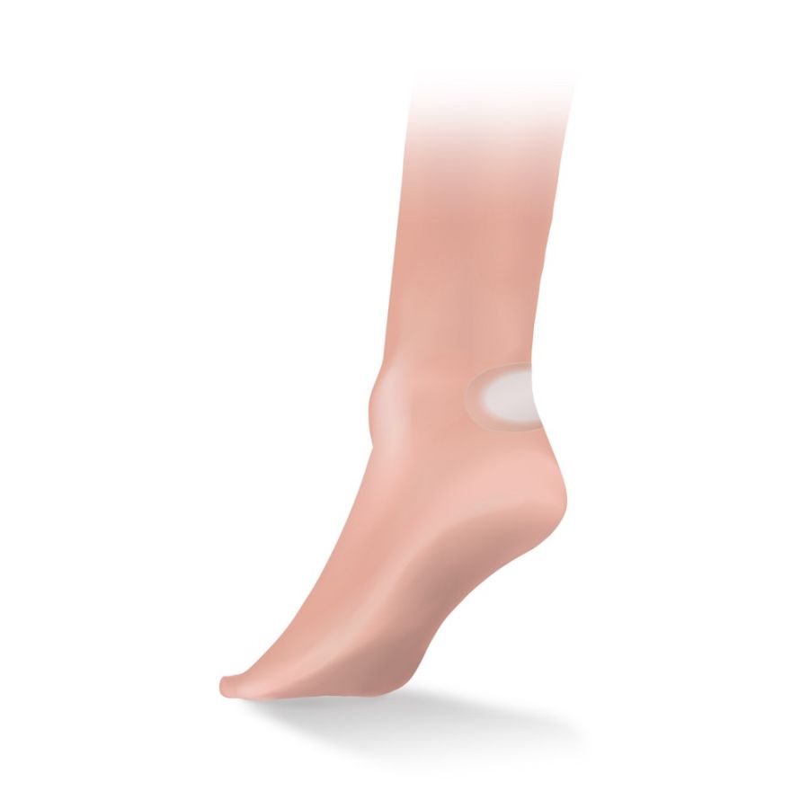 LS BLISTER PLASTERS - SIX PACK ANY b